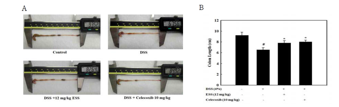 Protective effect of ESS treatment in DSS-induced colitis in mice. (A) Macroscopic images of colons in DSS-induced colitis mice. (B) Quantification of length of colons from each group mice obtained on Day 12 days