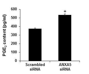 Annexin A5억제를 통한 PGE2의 양 변화. PC-3 세포에 annexin A5 siRNA transfection 후 세포 배양액 내의 PGE2 변화량 확인 (ELISA)