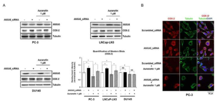 Auranofin 및 annexin A5 siRNA 동시 처리를 통한 COX-2의 발현 변화 (A-B) 전립선 암세포들에 annexin A5 siRNA transfection 24시간 후 auranofin 처리 (24시간). (A) PC-3, LNCaP-LN3, DU145세포들에서 COX-2의 protein 변화 확인 (western blot) (B) PC-3 세포에 서 COX-2 발현 변화 확인 (confocal analysis)