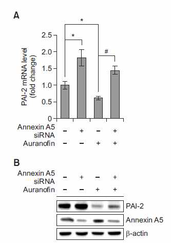 Annexin A5 억제 및 auranofin에 의한 PAI-2 발현 변화. (A-B) PC-3에 annexin A5 siRNA transfection 24시간 후 auranofin (1 μM)을 24시간 처리하였음. (A) PAI-2 mRNA 변화 확인 (qRT-PCR) (B) PAI-2 protein 변화 확인 (western blot)