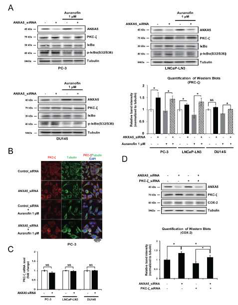 PKC-ζ 단백질 발현에서의 annexin A5의 효과 (A-B) Annexin A5 siRNA를 transfection 후 auranofin 처리 (A) PC-3, LNCaP-LN3, DU145 세포에서 PKC-ζ의 발현변화 확인 (western blot) (B) PC-3 세포에서 PKC-ζ의 발현변화 확인 (confocal analaysis) (C) PC-3, LNCaP-LN3, DU145 세포에 annexin A5 siRNA transfection 후 PKC-ζ의 mRNA 발현 변화 확인 (qRT-PCR) (D) PKC-ζ siRNA, annexin A5 siRNA를 동시에 transfection 후 COX-2의 발현변화 확인 (western blot)