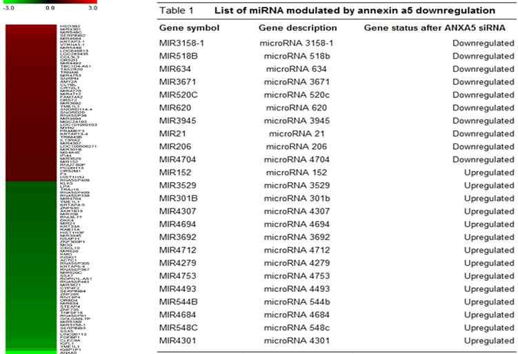 인체전립선암 세포주 PC-3에서 annxin A5 knockdown 후 변화하는 miRNA 종류 확인