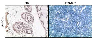 정상 마우스의 전립선과 TRAMP 마우스의 전립선에서 CIC의 발현의 비교. TRAMP 마우스의 전립선암 조직에서 CIC의 발현은 거의 되지 않음