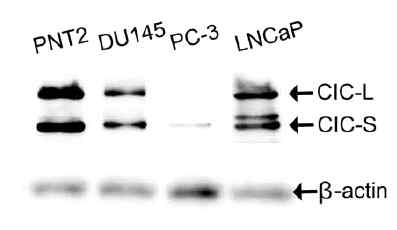 다양한 전립선 세포주들에서의 CIC 발현양 비교. PNT2: 정상 전립선 세포주, LNCaP: AR 발현 전립선암 세포주, DU145, PC-3: AR 비발현 전립선암 세포주들