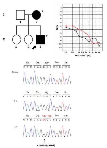 비증후군성 상염색체우성 가계의 가계도와 환자의 청력도 및 염기서열 분석을 통한 환자와 부모간의 variation을 비교분석