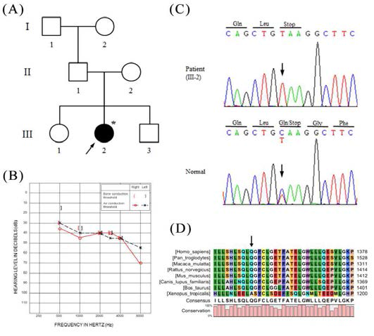차세대 염기서열기법을 통해 STRC 유전자의 nonsense 돌연변이(p.Q1353X)가 발견된 상염색체 열성 비증후군성 난청 가계인 KNUF19 가계