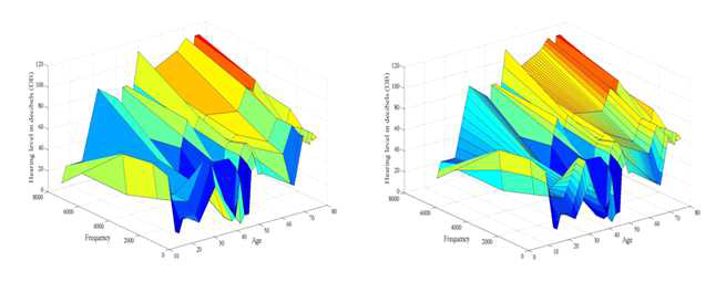 다차원 보간법을 이용한 청력도 기반 모델. 환자의 나이를 고려한 DFNA6 유전자이상에 의한 14명 남성의 청력도를 나타낸 모형(왼쪽). 오른쪽 모형은 왼쪽 그림의 자료를 바탕으로 3차원 보간법을 사용하여 얻어진 보다 정밀한 형태의 곡면 그림