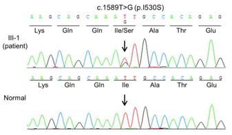 난청가계에서 발견된 DIAPH1 유전자의 p.I153S 돌연변이