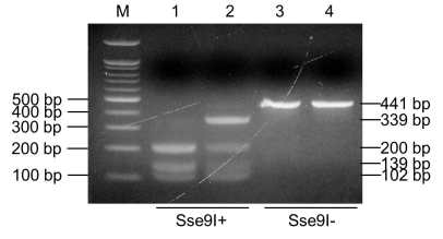 DIAPH1 유전자에서 발견된 p.I153S에 대한 RFLP분석