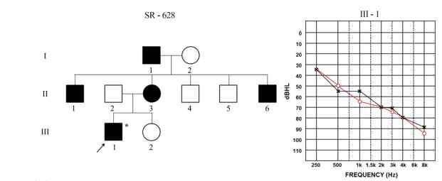 MYH14 유전자에 돌연변이를 가지는 난청가계의 가계도와 환자의 청력도