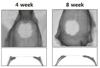 골 결손 후, 4주와 8주 째 micro CT를 통한 골 재생 분석