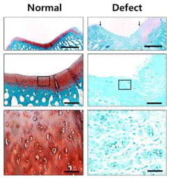 연골 결손 후, safranin O염색을 통한 손상 연골 재생능 비교