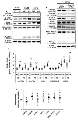 HSP25-mediated ER stress in KO mice following KA injection. (A) Representative western blot of ER stress-related molecules. P2X7R deletion induces ER stress following KA injection. (B) Effect of HSP25 knockdown in HSP25-mediated ER stress. HSP25 siRNA attenuates HSP25-mediated ER stress in KO mice following SE. (C) Quantifications of ER stress-related molecules in KO mice following KA injection. Open circles indicate each individual value. Horizontal bars indicate mean value. Error bars indicate SEM (*,#p < 0.05 vs. control and WT mice, respectively). (D) Quantifications of effect of HSP25 siRNA on SE-induced ERstress (*p < 0.05 vs. control siRNA)