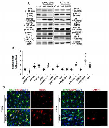 Effect of ERK1/2 inhibition on HSP25 expression in WT mice following KA injection. (A) Representative western blot of astroglial autophagy-related molecules. U0126 injection leads to HSP25-mediated astroglial autophagy in WT mice 7 days after SE. (B) Quantifications of effect of U0126 on HSP25-mediated astroglial autophagy in WT mice. (C) Representative photos demonstrating the effect of U0126 on HSP25 and LAMP1 expression in WT mice 7 days after KA injection. U0126 increases both HSP25 and LAMP1 expression in astrocytes. Bar = 25μm