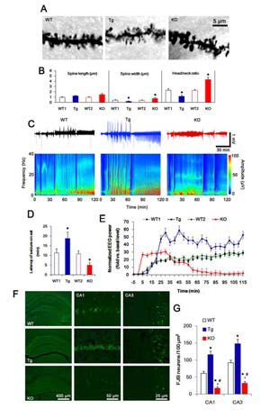 Profiles of seizure activity in PLPP/CINTg and PLPP/CIN-/-mice induced by KA. (A-B) Characteristics of dendritic spine morphology in PLPP/CINTg and PLPP/CIN-/-mice. (C-E) Seizure activity in response to KA. PLPP/CINTg mice demonstrate increases in seizure intensity, duration and the latency of seizure on-set, as compared to PLPP/CIN-/-mice. (F-G) KA-induced neuronal death. One day after KA injection, neuronal death in PLPP/CINTg mice is more severe than that in PLPP/CIN-/- mice, as compared to WT animals