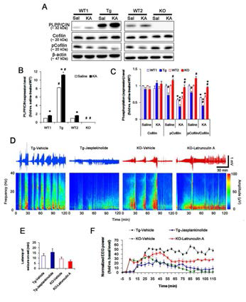 The role of F-actin dynamics in seizure activity induced by KA. (A-C) Changed PLPP/CIN expression and cofilin phosphorylation 2 h after KA injection. (D-F) The effect of F-actin dynamics on seizure activity in response to KA. Jasplakinolide (a F-actin stabilizer) decreases seizure intensity (total EEG power) in PLPP/CINTg mice, but latrunculin A( a F-actin depolymerizer) enhances it in PLPP/CIN-/- animals. However, neither jasplakinolide nor latrunculin Aa ffects the latency of seizure on-set in both groups