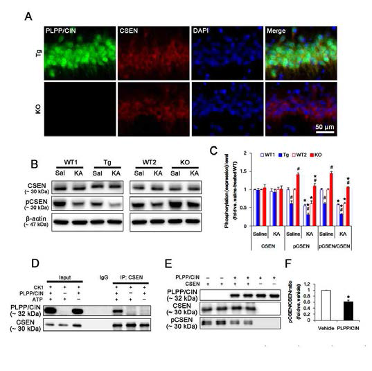 PLPP/CIN-mediated CSEN dephosphorylation. (A) Representative double immunofluorescent photos for PLPP/CIN and CSEN. PLPP/CIN is colocalized with CSEN in hippocampal neurons in PLPP/CINTgmice. (B-C) Changed CSEN phosphorylation 2h after KA injection. Western blot shows the CSEN phosphorylation is lower in PLPP/CINTg mice, but is higher in PLPP/CIN-/- mice. In addition, KA reduces CSEN phosphorylation without altered CSEN expression in WT animals. The reduced CSEN phosphorylation in PLPP/CINTg mice is more efficient, while that in PLPP/CIN-/- mice is less, as compared to WT animals. (D-F) In vitro assay using recombinant proteins. Co-immnoprecipitation and western blot reveal that PLPP/CIN binds to CSEN, and dephosphorylates CSEN