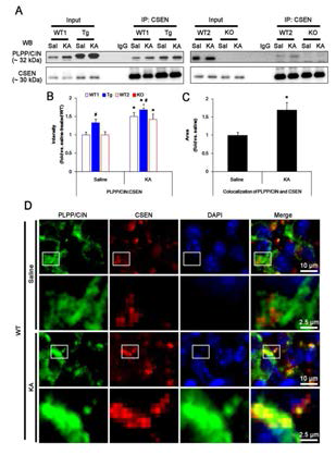 The effect of seizure activity on PLPP/CIN-mediated CSEN dephosphorylation invivo. (A-B) Changed PLPP/CIN-CSEN bindings 2 h after KA injection. Western blot shows that PLPP/CIN-CSEN co-precipitation in PLPP/CINTg mice is higher than WT animals under physiological condition. KA increases the binding of PLPP/CIN to CSEN in WT and PLPP/CINTg mice. (C-D) Colocalization of PLPP/CIN and CSEN. KA increases the area of colocalization of PLPP/CIN and CSEN in CA1 neurons