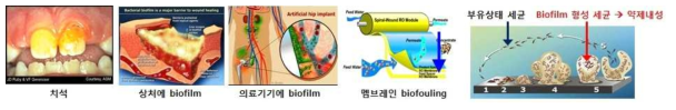 세균의 생물막 (biofilm)과 항생제 내성 모형