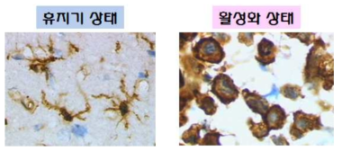 휴지기 상태와 활성화 상태에서의 미세아교세포 표현형