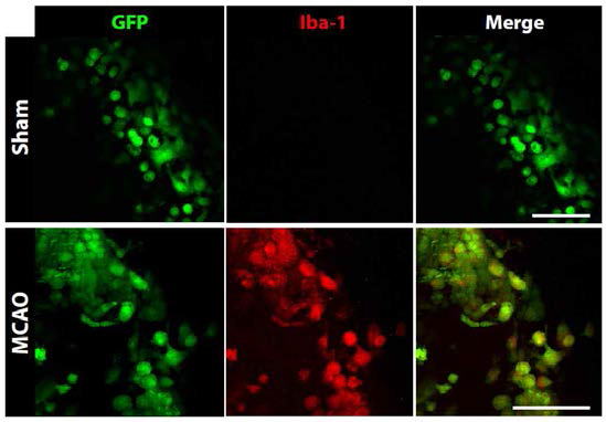 이광자 현미경을 사용, 뇌경색이 유도된 뇌 (MCAO)에서 관찰된 미세아교세포 특이적 시그널 (Iba-1). Bok et al. (2015)