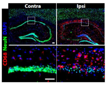 미세아교세포 특정 저산소유도인자 결실 마우스에서 허혈성 뇌경색 후 뇌를 적출하여 면역 염색을 실시한 결과. Ipsi - 허혈성 뇌경색 부위; contra - 허혈성 뇌경색 반댓편 부위; CD68 - 활성화된 미세아교세포; NeuN - 신경세포. Bok et al. (2017)