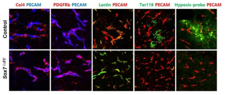 Sox7 내피-결핍 암혈관에서 혈관의 비정상도가 경감됨