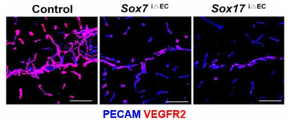 Sox7, Sox17 결핍 신생아 뇌혈관에서 VEGFR2의 발현이 저하됨