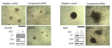 보체 siRNA을 암줄기세포에 처리한 후, 형태학적 변화 검증