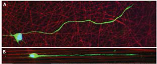 (A)무질서한 nanofiber와 (B) 한 방향으로 정렬된 nanofiber 위에서 배향된 신경세포의 성장