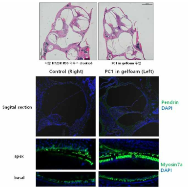 PC1 약물의 조직학적 효과