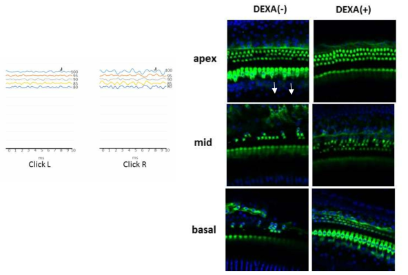 Human p.H723R pendrin knock-in mouse에서 Dexamethasone을 투여한 측과 반대측의 ABR 및 immunostaining 결과