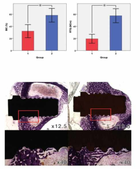 표면조도 및 제작공법에 따른 Osseointegration 비교