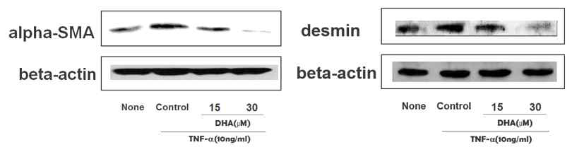 췌장 성상세포에 DHA를 전처리하고 12시간 동안 TNF-α를 투여한 후, total 단백질을 분리한 뒤 Western blot을 이용하여 α-SMA, desmin 단백질량의 발현변화를 측정하였음