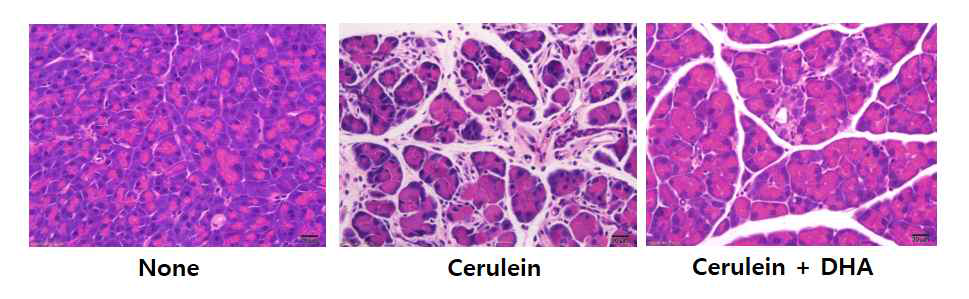 마우스에 cerulein 및 오메가 3 지방산 (DHA)을 투여한 뒤, 췌장조직을 section한 뒤 HE stain한 후 조직학적 변화를 관찰함