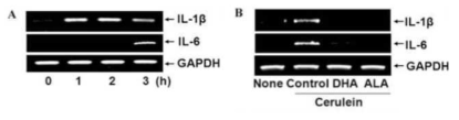 췌장 선세포에 ceruelin 및 오메가 3 지방산 (DHA, ALA)를 처리한 후, RT-PCR법을 이용하여 IL-1β와 IL-6 mRNA의 발현변화를 측정함