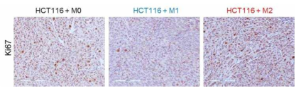 TAM 에 의한 마우스 종양조직내의 ki67 발현 변화