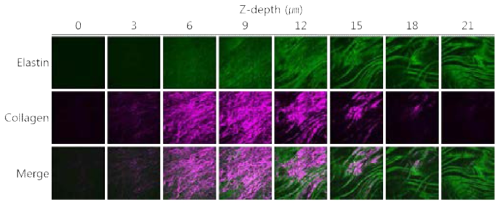 혈관조직의 콜라겐과 엘라스틴의 멀티모드 이미징 결과