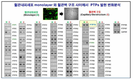 망막혈관내피세포 및 혈관벽으로의 분화과정에서 PTPs들의 발현 양상 비교분석