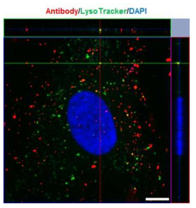 ScFv-ferritin 단백질나노입자의 세포내 유입경로 분석