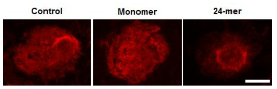 ScFv-ferritin 단백질 나노입자의 안구 혈관 투과성 조절능 확인