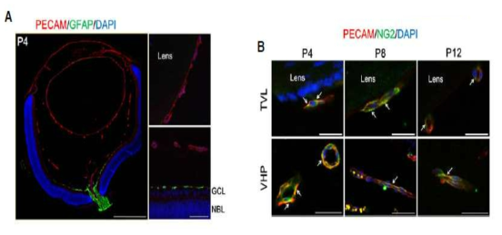 안구내 혈관에서 혈관내피세포와 주위세포의 상호작용 이미징 (PECAM: 혈관내피세포; NG2: 주위세포)