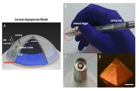기능성 나노바이오컴포지트 안구 적용을 위한 microneedle개발