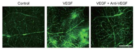 당뇨망막병증의 특징인 혈관투과성 증가 유도 동물모델 확립