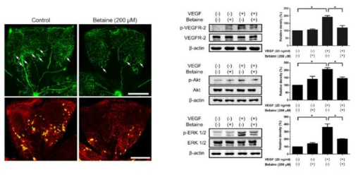 당뇨망막병증의 혈관신생 모델 확립 및 reactive oxygen species억제를 통한 VEGF신호전달기전 조절 규명