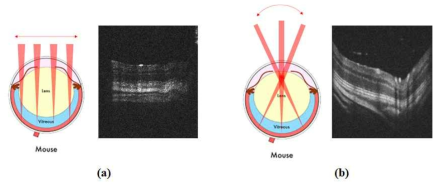 BALB/c 마우스 망막 OCT 이미지. (a) 초점이 맺히는 빛이 들어가 스캐닝하는 방식, (b) 평행한 빛이 들어가 눈의 렌즈에 의해 초점이 맺히는 스캐닝 방식