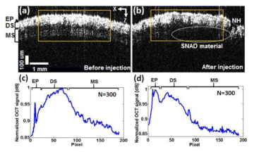 SAND 주입 전/후의 in vivo OCT 결과. (a) 주입 전 OCT 이미지, (b) 주입 후 OCT 이미지, (c) 이미지 a의 노란 박스로 표시된 부분의 신호 세기 그래프, (d) 이미지 b의 노란 박스로 표시된 부분의 신호 세기