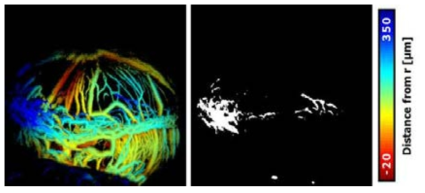 (a) 광음향 현미경으로 찍은 혈관 신호를 검출된 안구 표면에서의 거리마다 다른 색으로 나타낸 이미지, (b) 화학적 손상 후 비정상적으로 자란 혈관들을 검출한 이미지