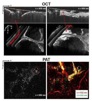 Chick embryo 내부에 주입된 fried-egg-shaped Au nanodisk (FAN)의 OCT 이미지 (입사파장 850 nm) 및 PAT 이미지 (입사파장 532, 650 nm)