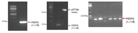 MDM2 단백질 cloning. (좌) PCR product 의 agarose gel electrophoresis (중) Restriction enzyme digestion (우) colony PCR 을 통한 colony selection